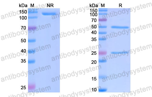 Валидация SDS-PAGE - AntibodySystem DHA30605
