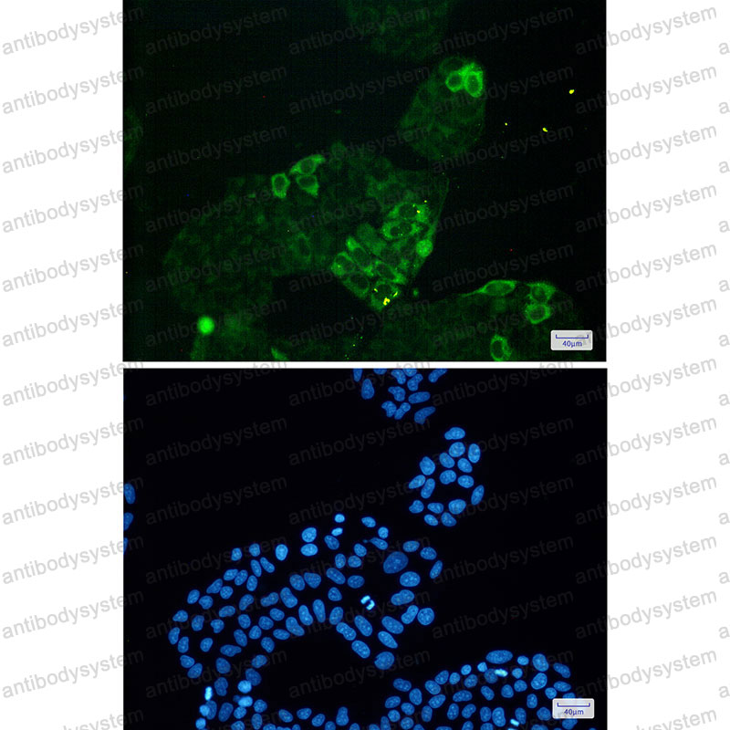 Валидация IF - AntibodySystem RMD05701