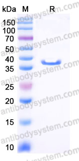 YHE68302, SDS-PAGE