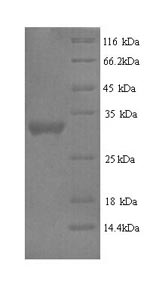 SDS-PAGE