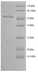 SDS-PAGE