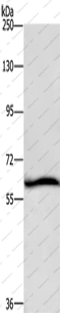 Вестерн-блоттинг, DCP1A, клетки HeLa