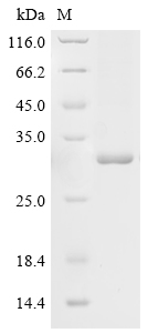 SDS-PAGE