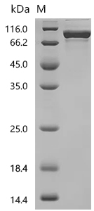 SDS-PAGE