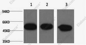 Вестерн-блоттинг, beta Tubulin, клетки HeLa и ткань мозга мыши и крысы