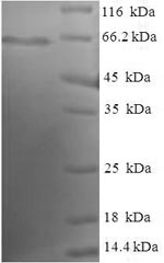 SDS-PAGE
