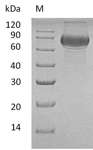 SDS-PAGE
