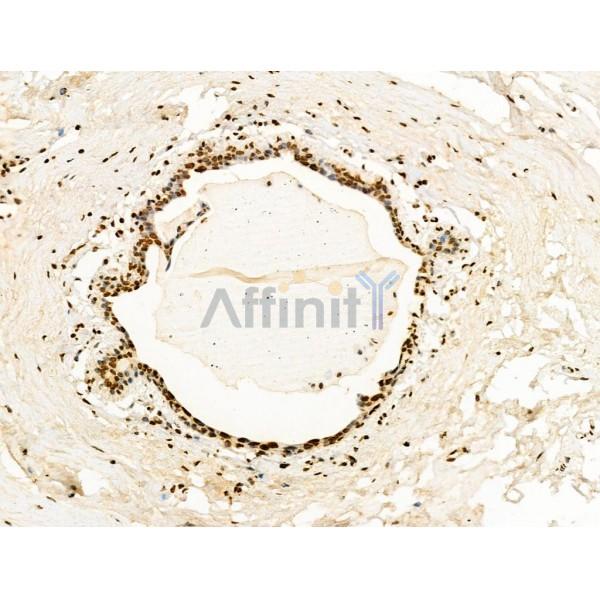 Валидация Affinity AF4361 - 2199