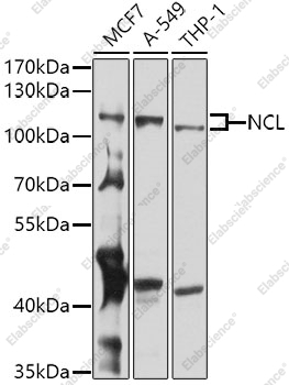 Вестерн-блоттинг, NCL, различные клеточные линии