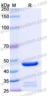 YHH07902, SDS-PAGE