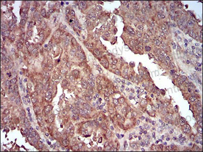 Валидация AntibodySystem RHE84303 (2364)