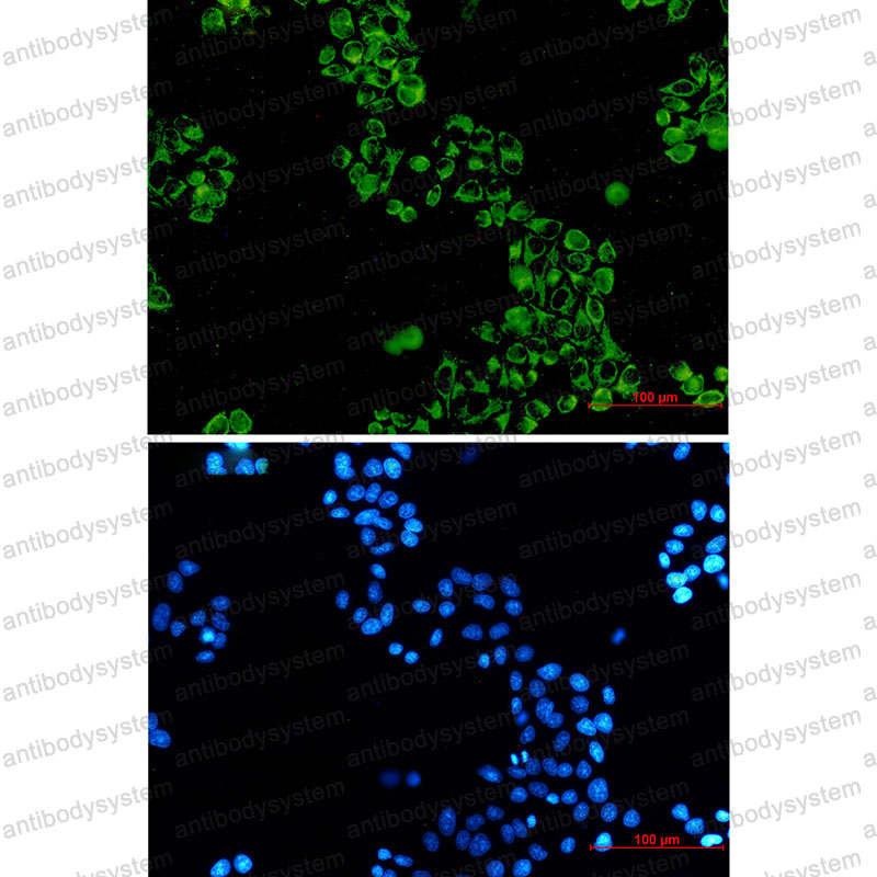 Валидация IF - AntibodySystem RHG11201