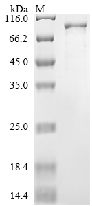 SDS-PAGE