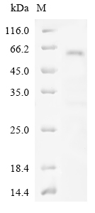 SDS-PAGE