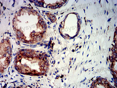 Валидация AntibodySystem RHC27101