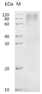 SDS-PAGE