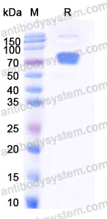 AHD62602, SDS-PAGE