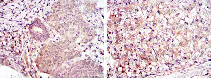 Валидация AntibodySystem RHE92203