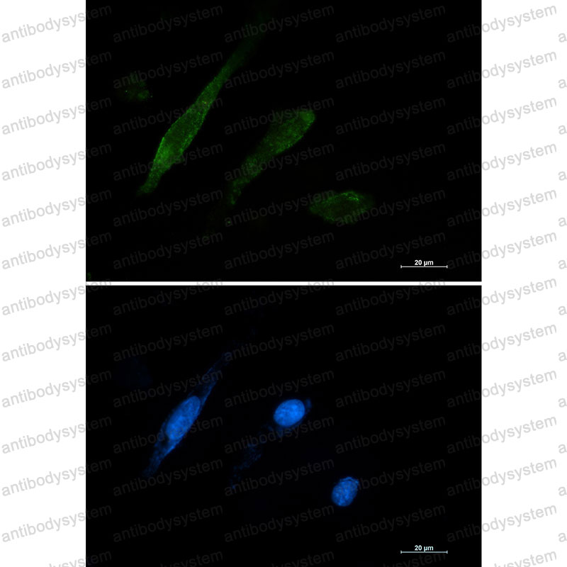 Валидация IF - AntibodySystem RHD27107