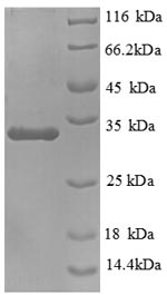 SDS-PAGE