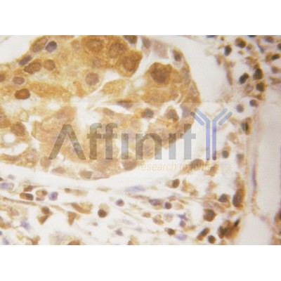 Валидация Affinity AF6017 - 3206