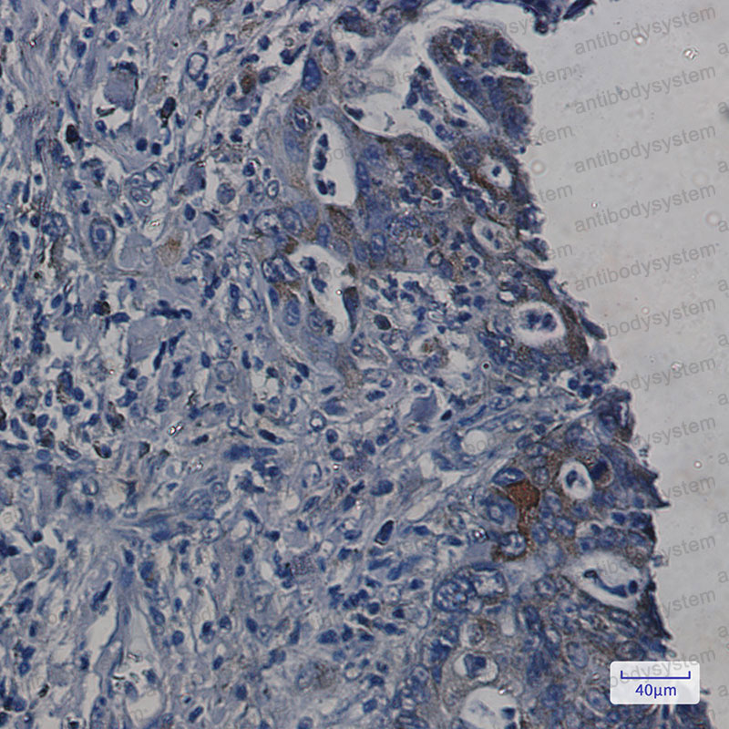 Валидация AntibodySystem RHJ88501