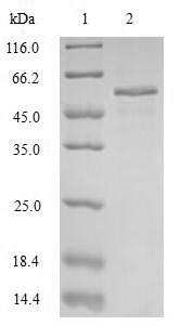 SDS-PAGE