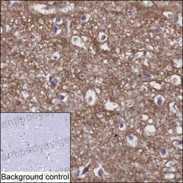 Валидация AntibodySystem RHH33505