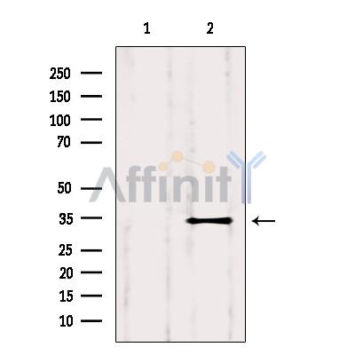 Валидация Affinity AF6178 - 3398