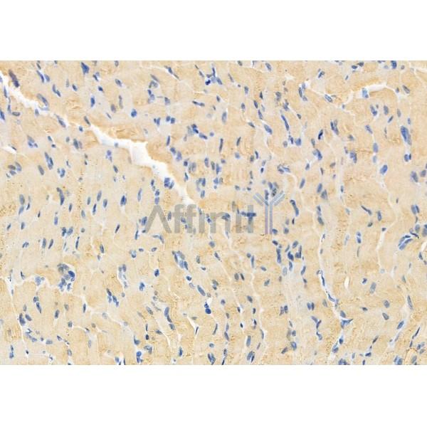 Валидация Affinity DF8542 - 20428