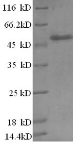 SDS-PAGE