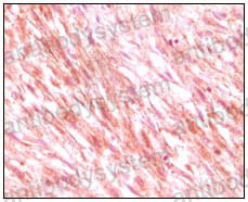 Валидация AntibodySystem RHC83102