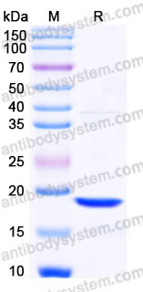 EHC01301, SDS-PAGE