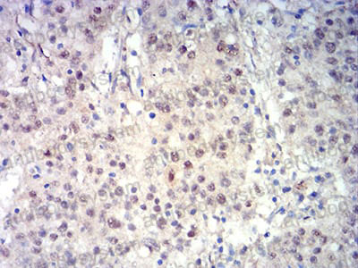 Валидация AntibodySystem RHN82802