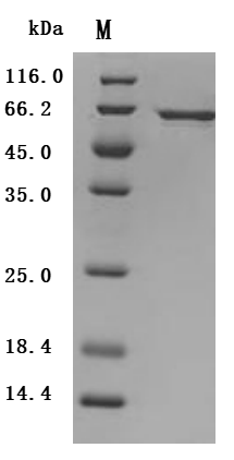 SDS-PAGE