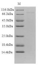 SDS-PAGE