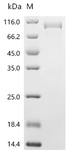 SDS-PAGE