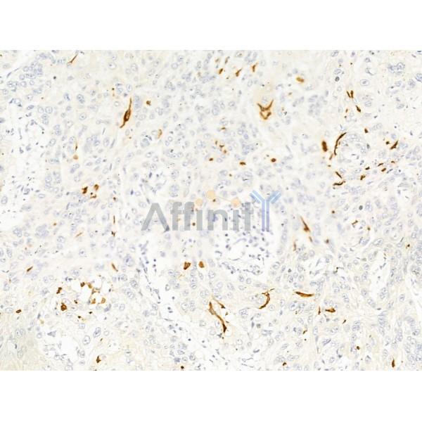 Валидация Affinity DF8532 - 20409