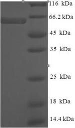 SDS-PAGE