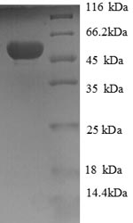 SDS-PAGE
