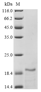 SDS-PAGE