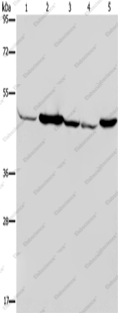 Вестерн-блоттинг, IDH2, ткань мышц плода человека, клетки Jurkat, 293T, HeLa и ткань печени мыши