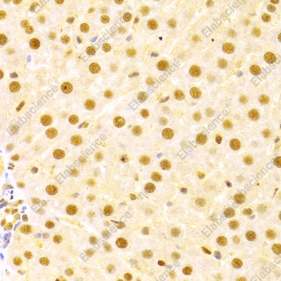 Иммуногистохимия, CDC25A, ткань печени человека с патологией