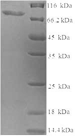 SDS-PAGE