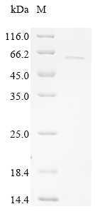 SDS-PAGE
