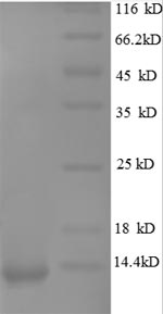 SDS-PAGE
