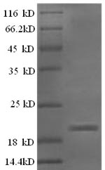 SDS-PAGE