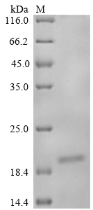 SDS-PAGE