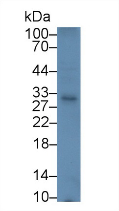 14757