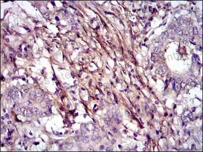 Валидация AntibodySystem RHC00804 (537)